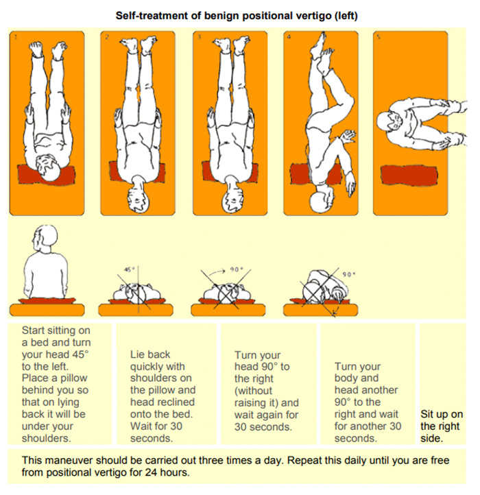 vertigo head movement exercises